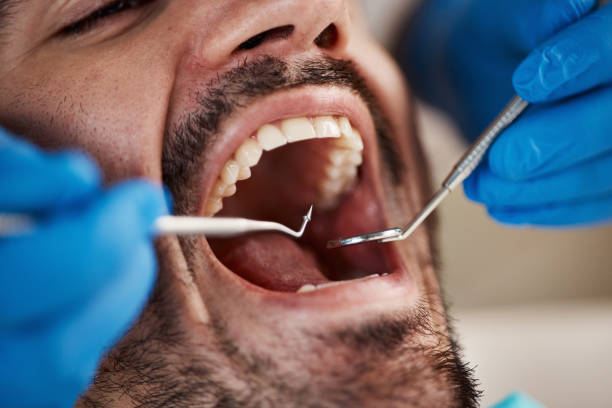 Best 24-Hour Emergency Dental Care in Detroit Beach, MI