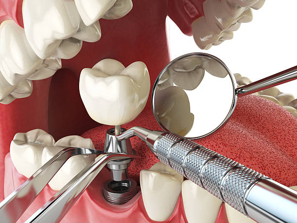 Best Emergency Treatment for Oral Infections in Detroit Beach, MI